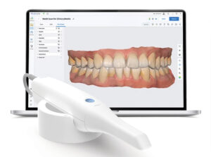 Intraorální scanner pro digitální protetický otisk a ve spolupráci s CBCT také pro plánování v implantologii